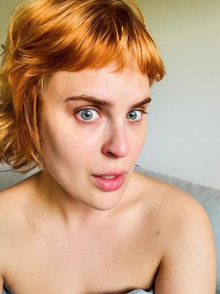 Tallulah Willis reveals ‘real’ face after having filler dissolved